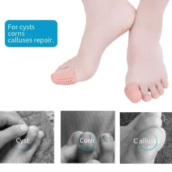 Fußschutz aus Silikongel – bequeme Kissen zur Schmerzlinderung