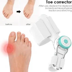 Großzehen-Geradehalter – Einstellbare Fußpflegelösung