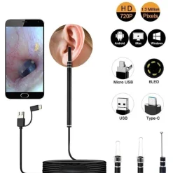 Mini-Ohrreinigungskamera – visuelles Werkzeug zur Ohrenschmalzentfernung