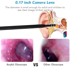 Mini-Ohrreinigungskamera – visuelles Werkzeug zur Ohrenschmalzentfernung
