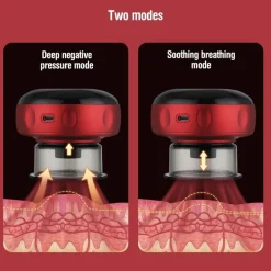 Schröpfmassagegerät – Vakuumtherapie-Massagegerät zur Schmerzlinderung