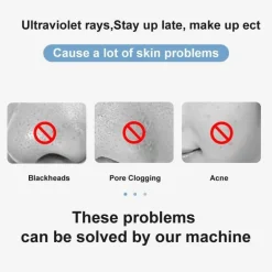 Ultraschall-Gesichtsmassagegerät – Tiefenreinigendes Hautwerkzeug