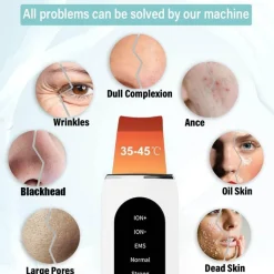 Ultraschall-Gesichtsreiniger – Tiefenreinigendes Anti-Akne-Gerät