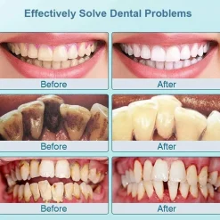 Ultraschall-Zahnreiniger-Set – wiederaufladbares Mundpflegesystem