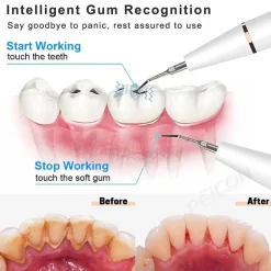 Ultraschall-Zahnreiniger-Set – wiederaufladbares Mundpflegesystem