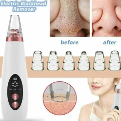 Wiederaufladbarer Mitesserentferner - Pure Skin Vacuum Porenreiniger