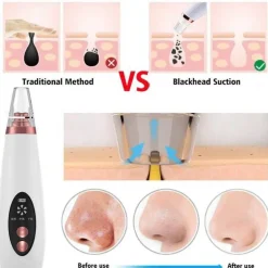 Wiederaufladbarer Mitesserentferner - Pure Skin Vacuum Porenreiniger