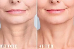 Wiederverwendbare Anti-Falten-Pads aus Silikon – Hautpflegebehandlung