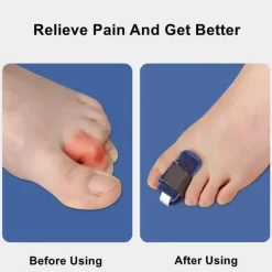 Zehenkorrektor – Sanfte Fußstabilisierungsunterstützung