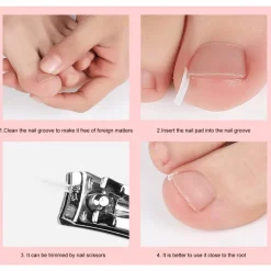 Zehennagel-Stützpolster – Komfortkissen zur Linderung von Zehennagelschmerzen